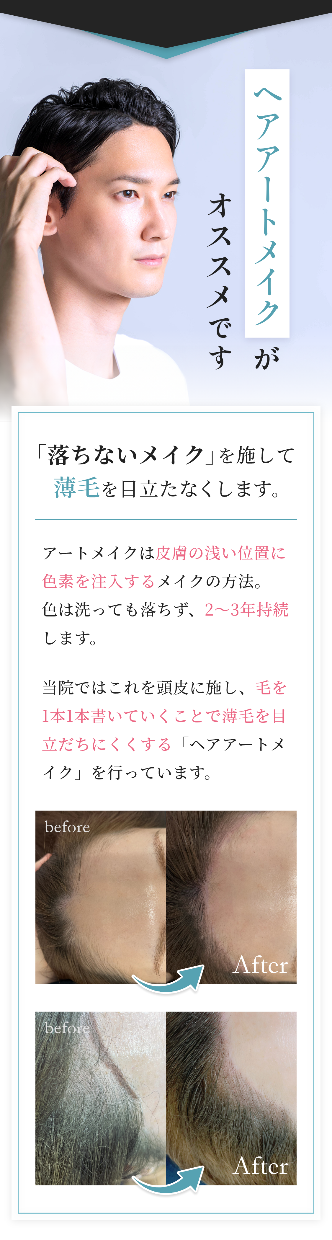 ヘアアートメイクがおすすめ